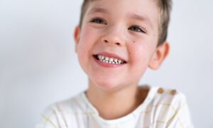 Consejos para la ortodoncia en niños. Ortodoncia invisible en Oviedo