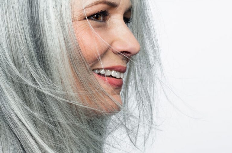 Mujer llevando implante dentales