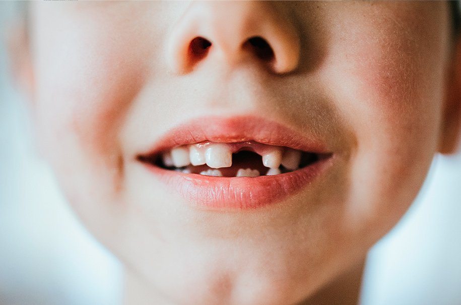 ¿Sabías que se pueden donar los dientes de leche?