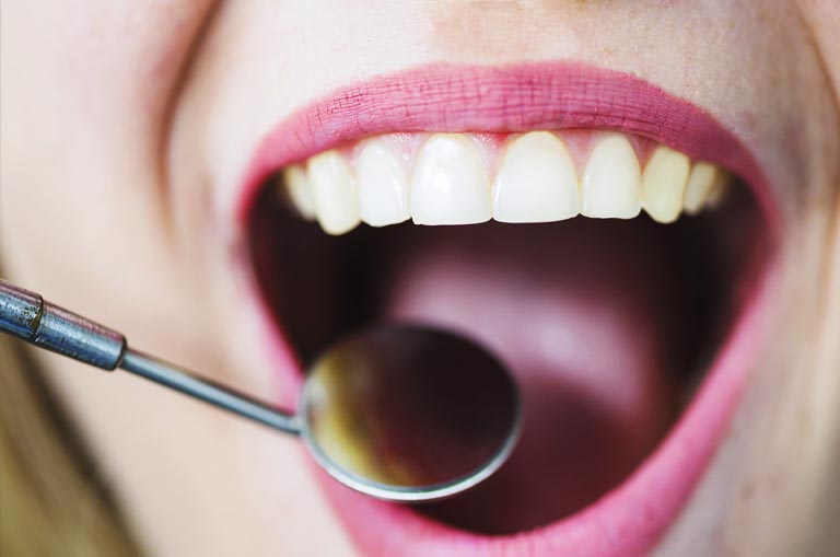 Injertos de encía. ¿Qué son? Clínica Bousoño Vargas. Implantes en Oviedo