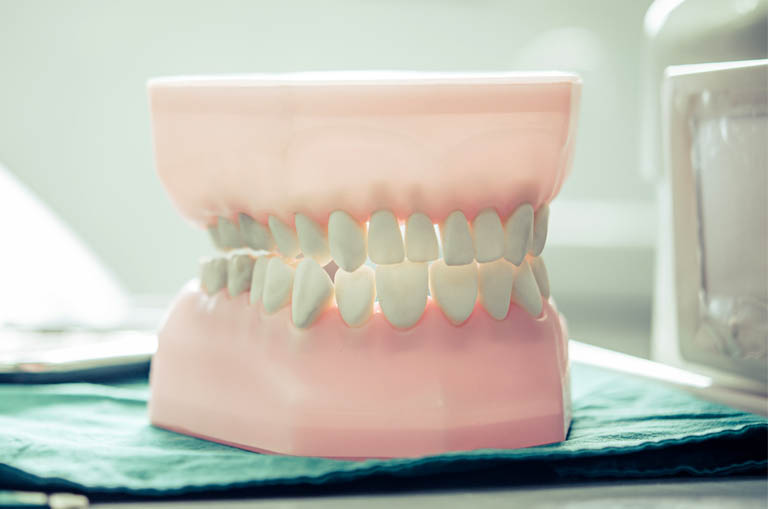 ¿Qué es una corticotomía? Clínica Bousoño Vargas. Ortodoncia en Oviedo