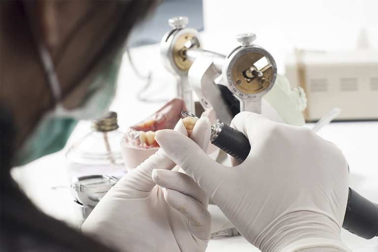 Qué es la prostodoncia. Bousoño Vargas. Implantes dentales en Oviedo.