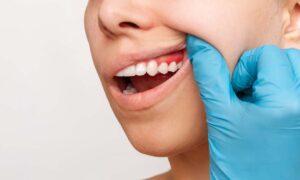 ¿Sabes qué es la cirugía estética de la encía?. Clínica Dental Bousoño Vargas. Dentista en Ovied