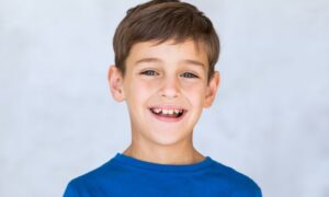 Ortodoncia en niños - Bousoño Vargas - Ortodoncia Invisible en Oviedo