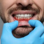 Paciente con una mala higiene dental