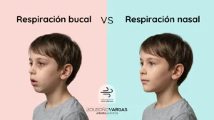 Ejemplo de cara de niño con respiración bucal versus respiración nasal