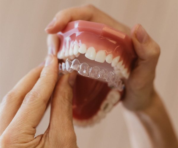 Mostrando cómo poner el sistema invisalign - ortodoncia invisible en Oviedo